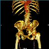 Stented Abdominal Aorta 16Bits